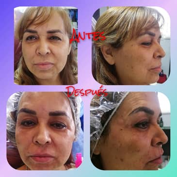 Slider image (3) NES Regenerative Medicine Clinic